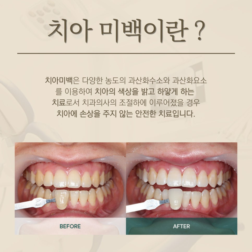 연세엘치과 이미지