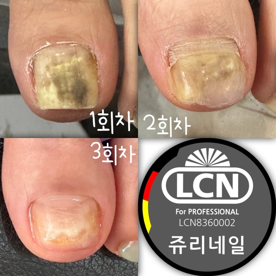 쥬리네일 이미지