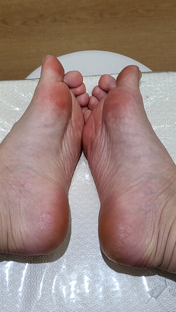 디블링네일 이미지