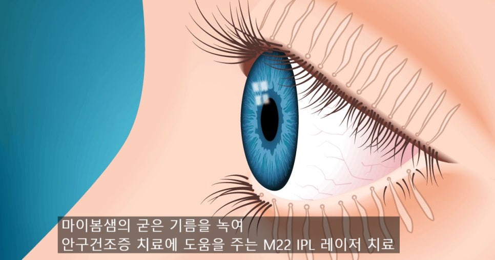 마곡드림빛안과의원 이미지