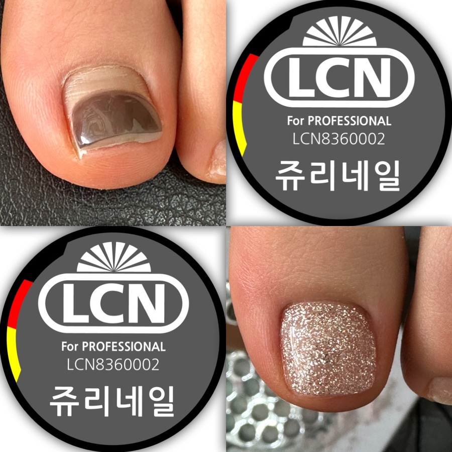 쥬리네일 이미지
