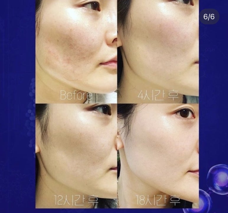 엑소바이옴코리아 주식회사 이미지