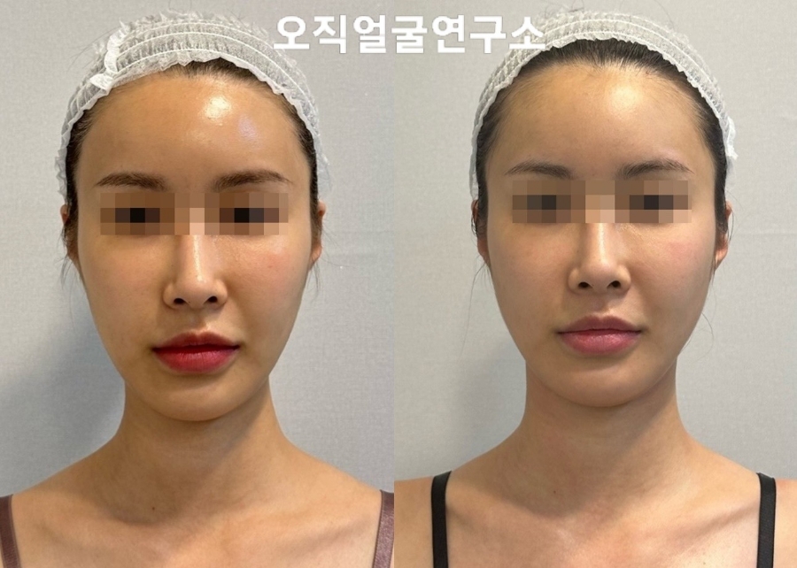오직얼굴연구소 이미지