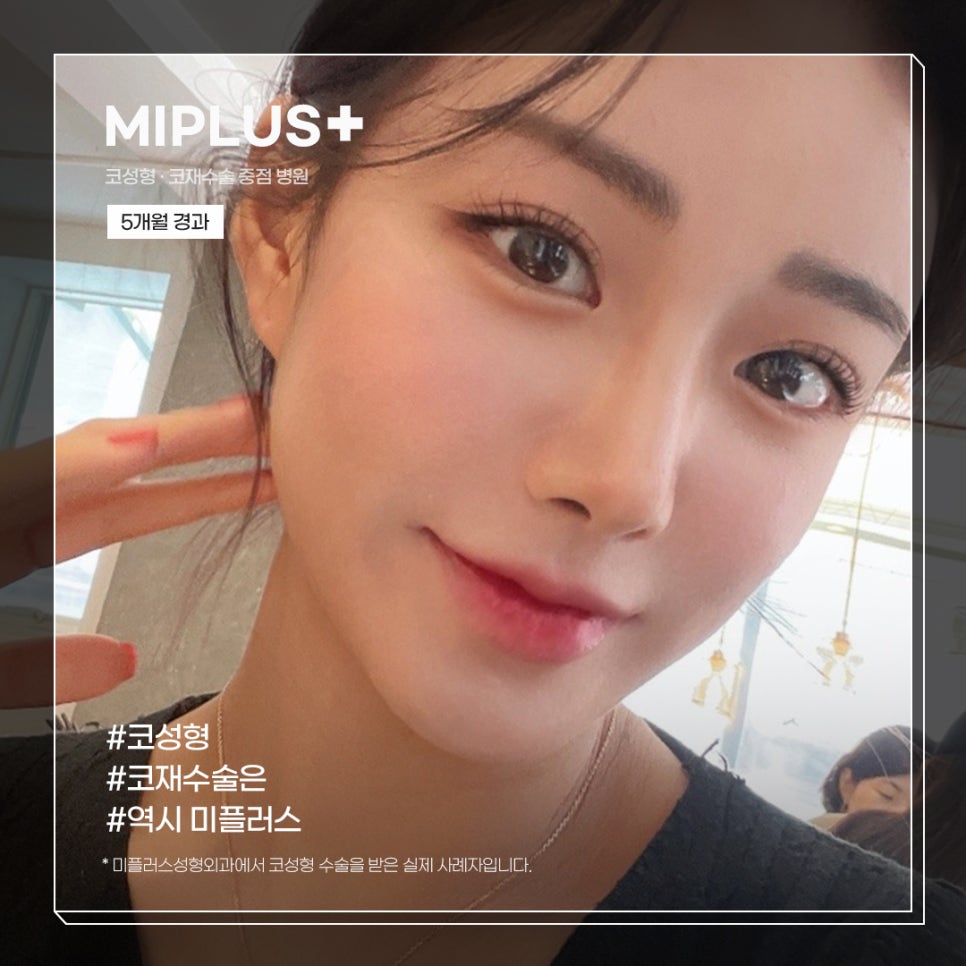 미플러스 이미지