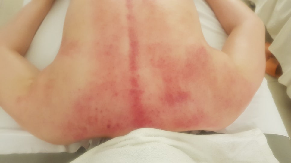 스킨톡에스테틱 이미지