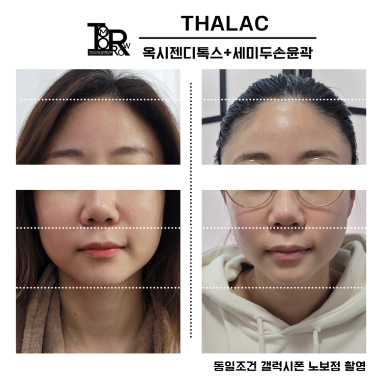 봄빛테라피 이미지