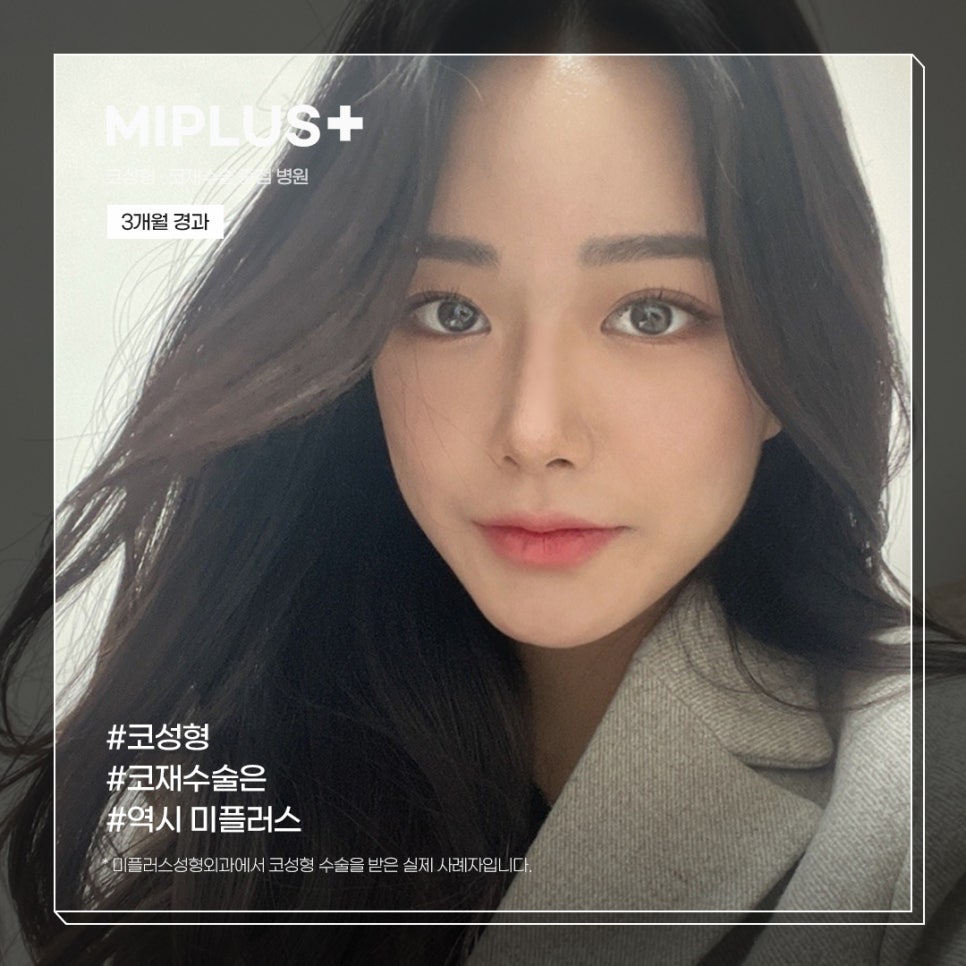 미플러스 이미지