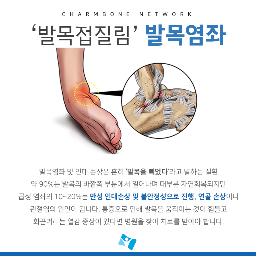 발목 인대 늘어남 치료법(+파열 회복기간) : 네이버 블로그