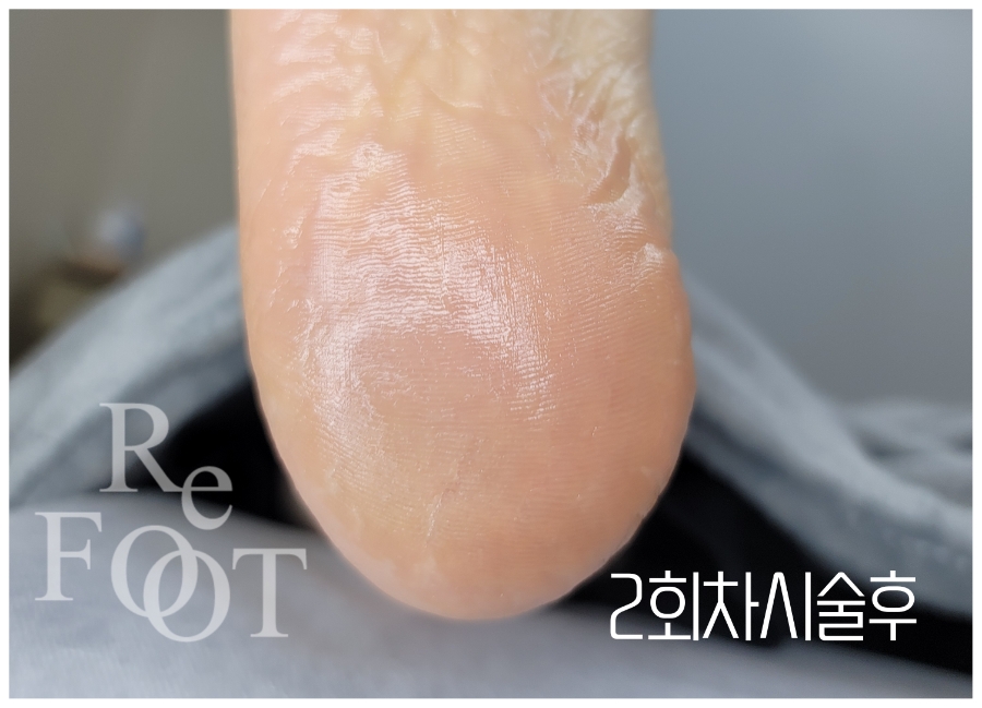 리풋 이미지