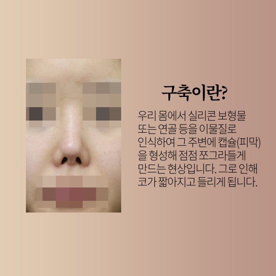 아너스티성형외과의원 이미지