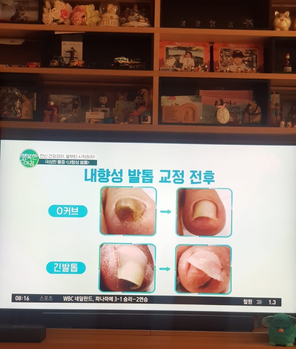페디Bio 이미지