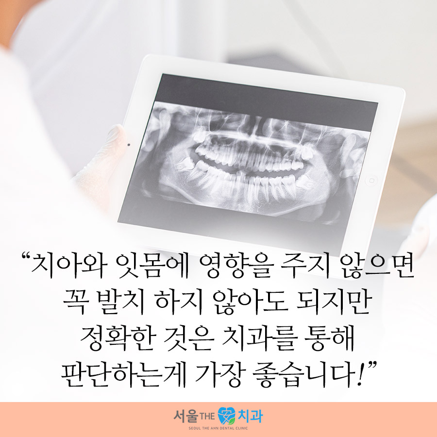 서울턱사랑니치과 이미지