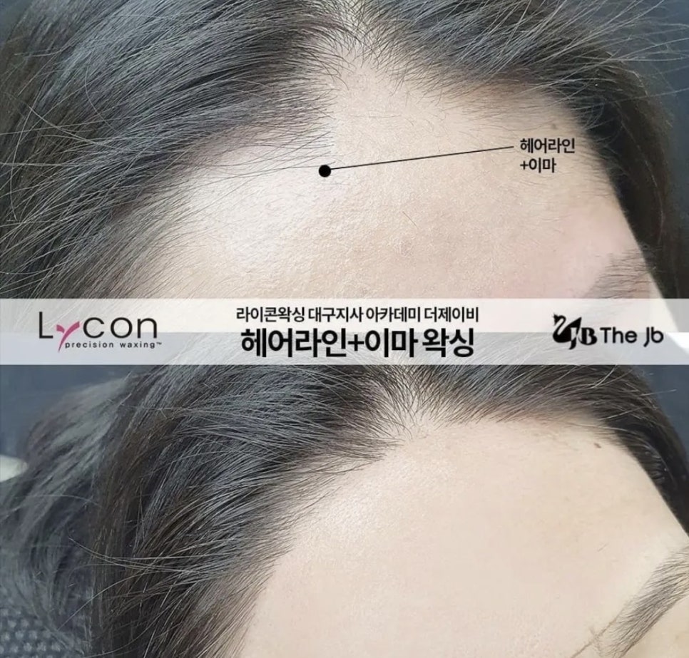 제이비라인 이미지