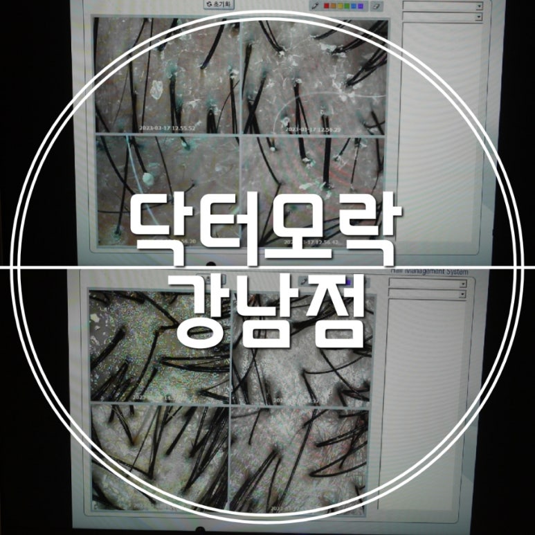 닥터모락 강남점 이미지