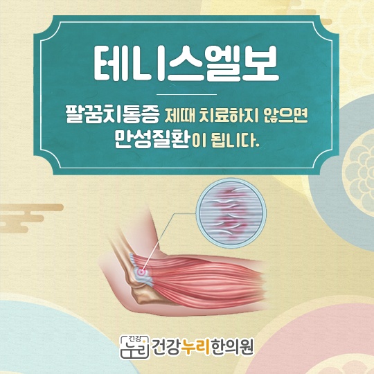 여성건강누리 이미지