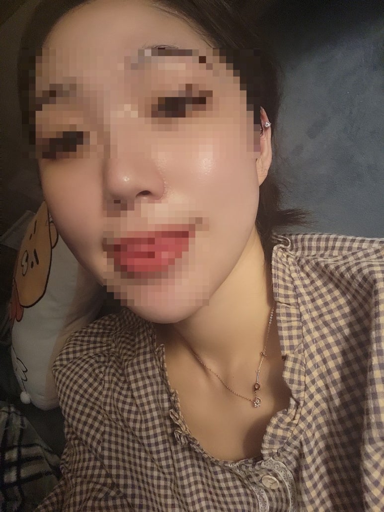 베카로움 이미지
