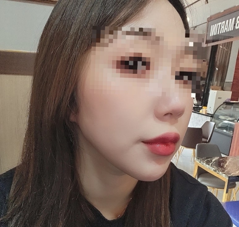 베카로움 이미지