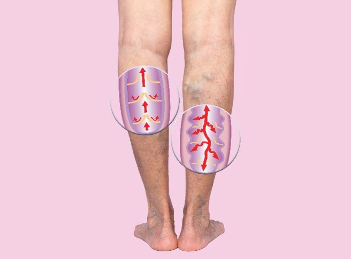 건강보감 이미지