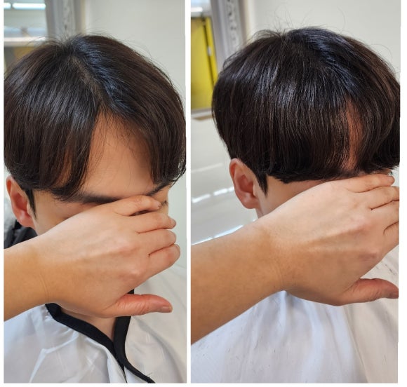 모모즈헤어&증모 이미지