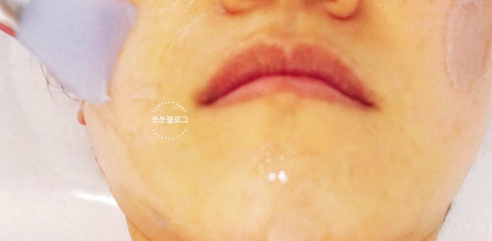 마쏘스킨바디 이미지