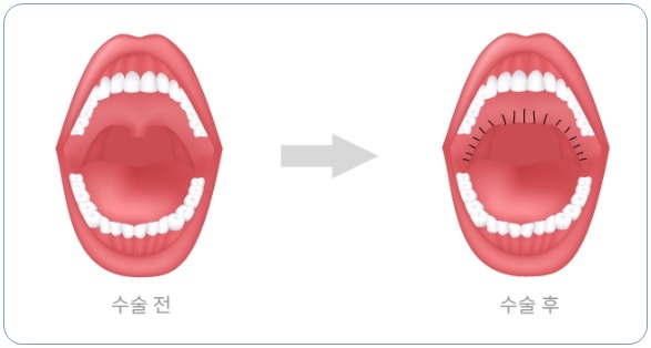 법인두그린 이미지