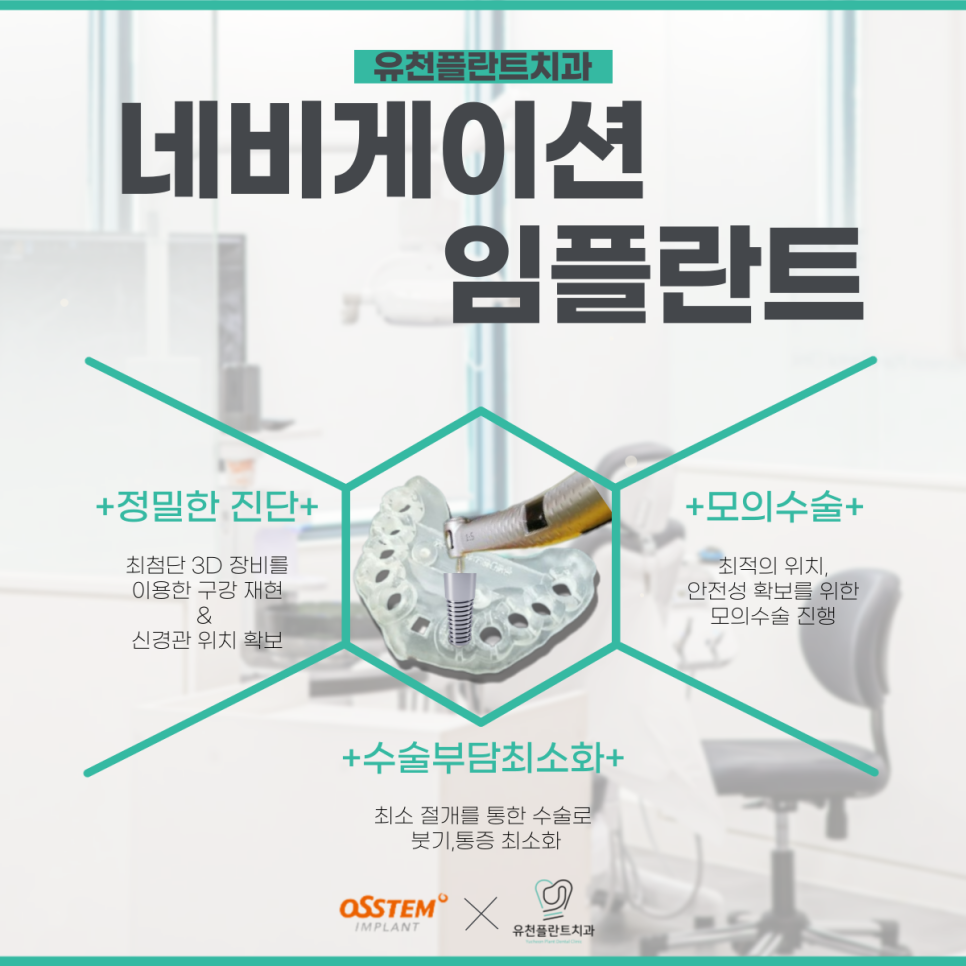 유천플란트치과 이미지