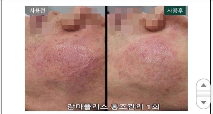 해라뷰티 이미지