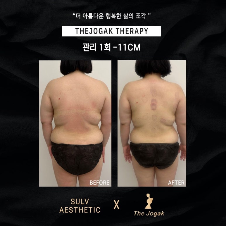 더조각테라피 이미지