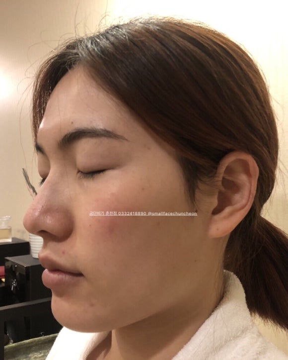 금단비가(춘천점) 이미지