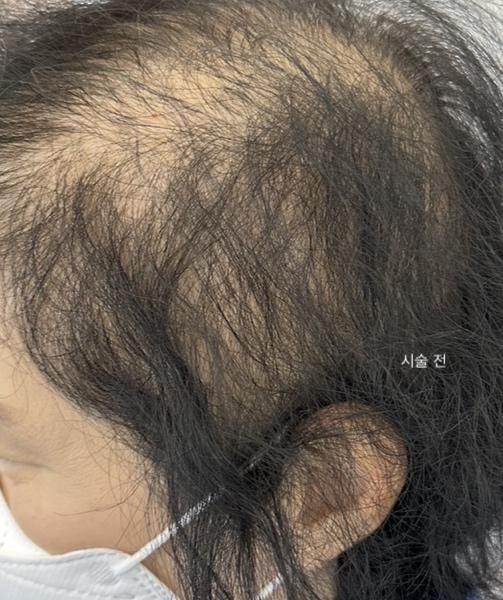 제니뷰티 이미지