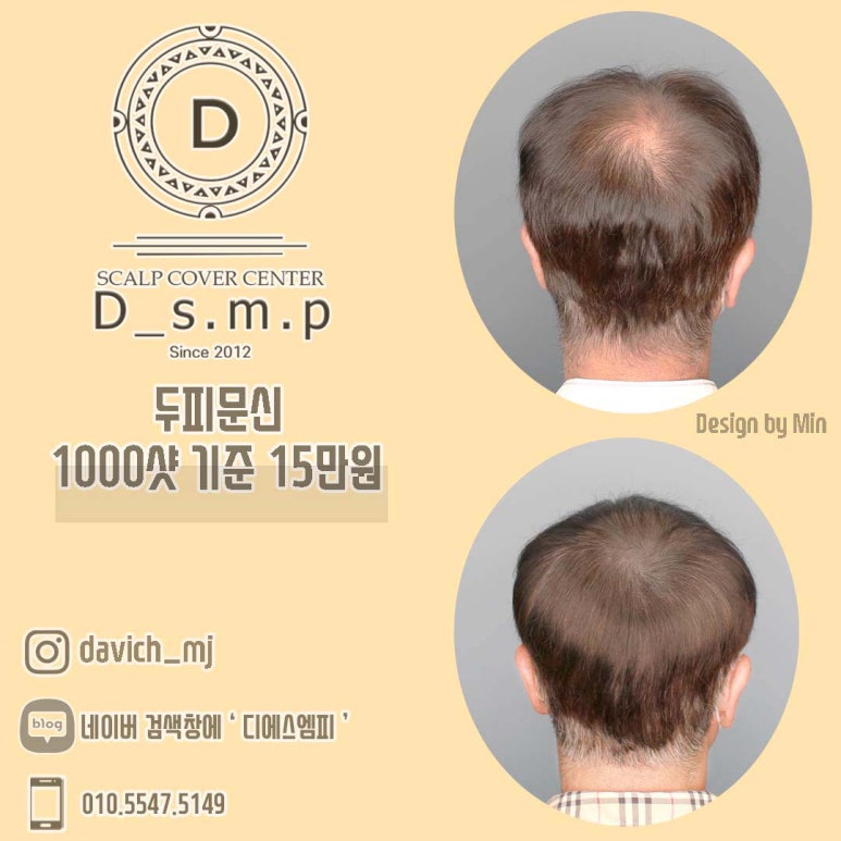 디에스엠피 이미지