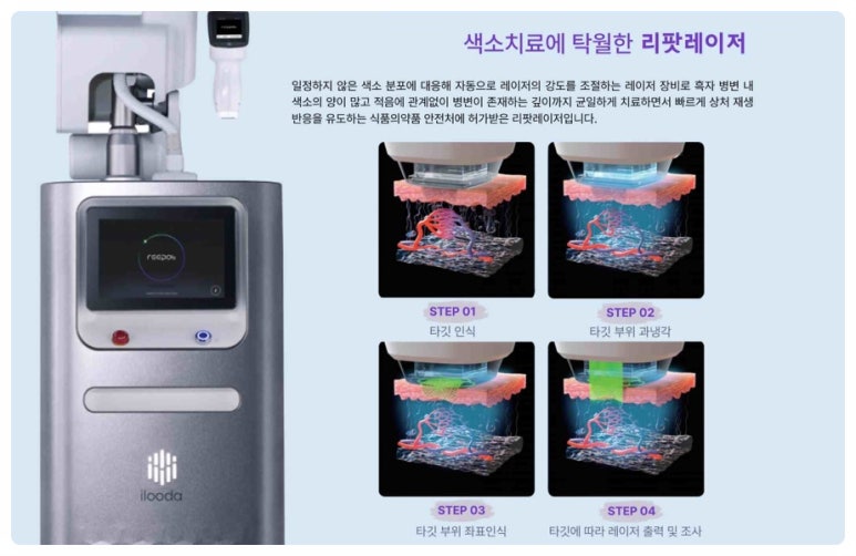 미소가인 이미지