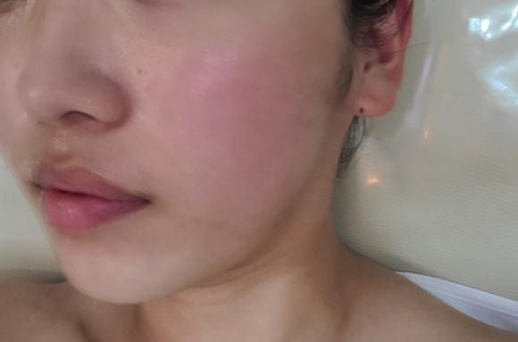 라헬스킨 이미지
