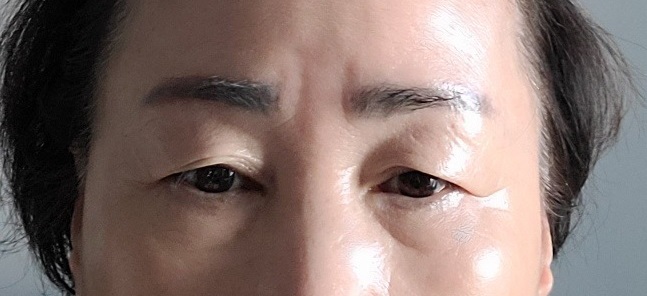 라이블리성형외과의원 이미지