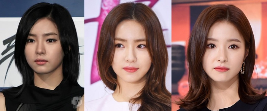 아르피온 이미지