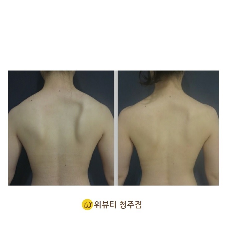 위뷰티 이미지