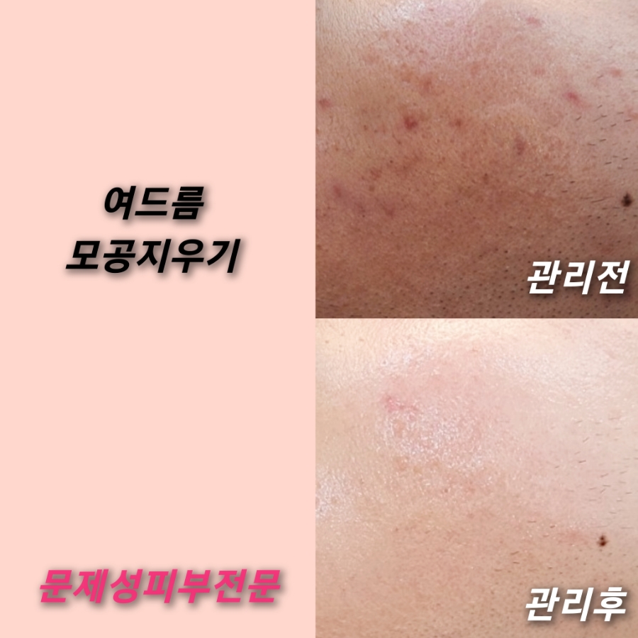뷰티샵더예쁘다 이미지