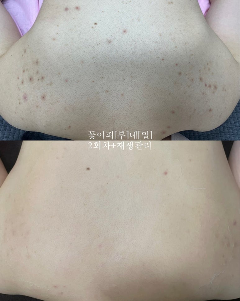 로즈 네일 & 피부 이미지
