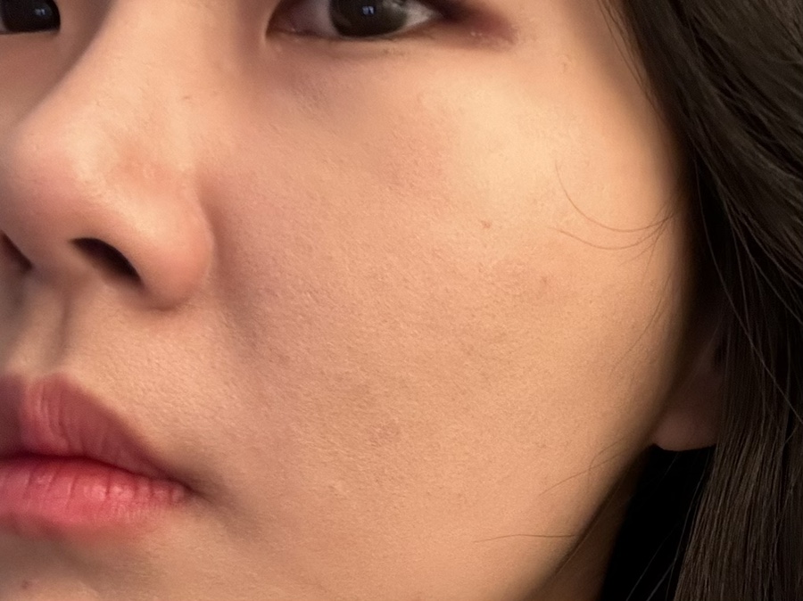 루비스킨케어 이미지