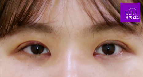비씨아이 이미지