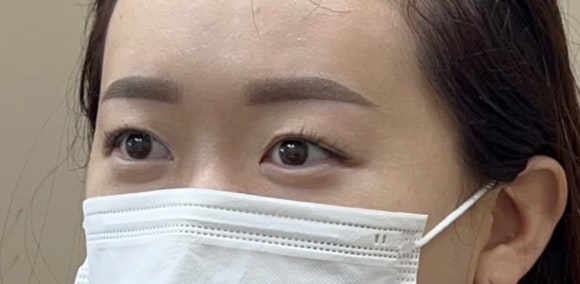 브로피시 이미지