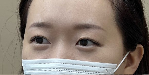 브로피시 이미지