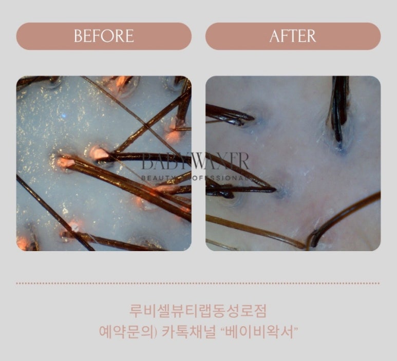 베이비왁서BW 이미지