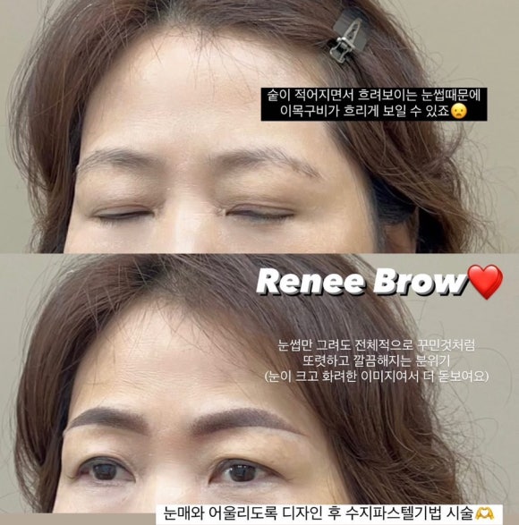 브로피시 이미지