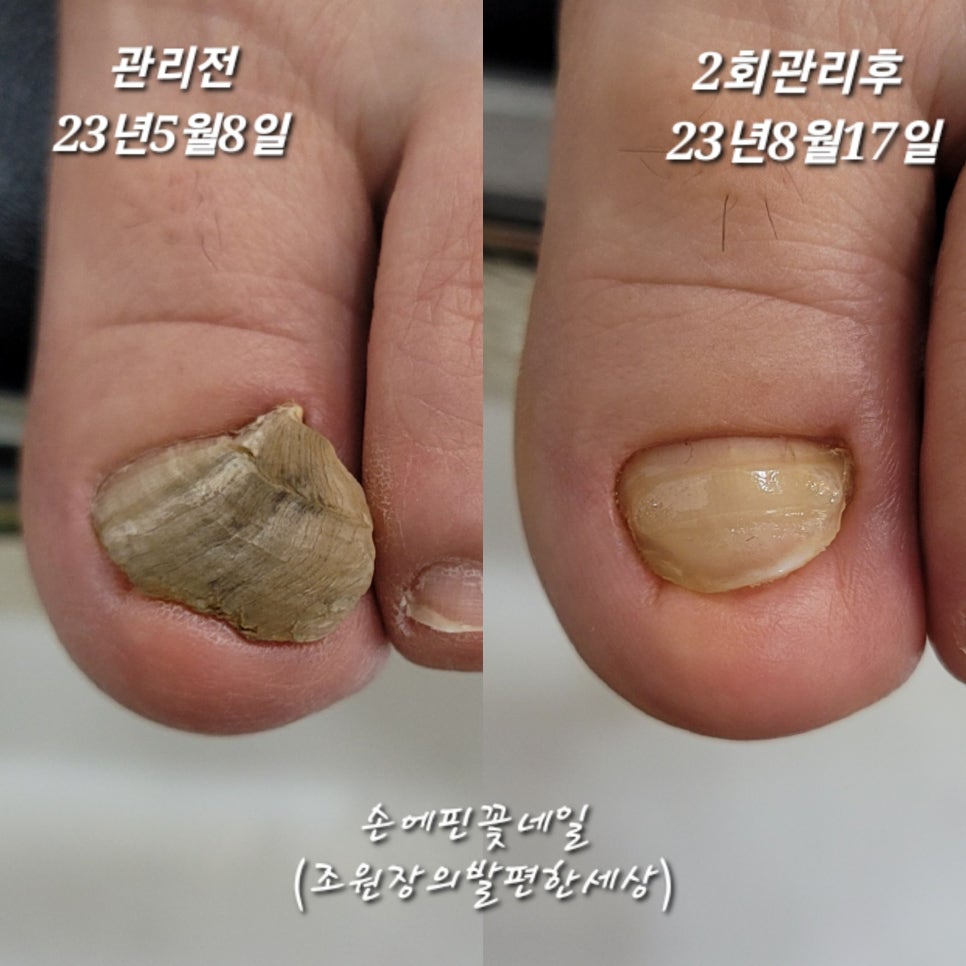 손꽃네일 이미지