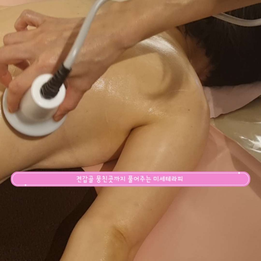 알파테라피 이미지