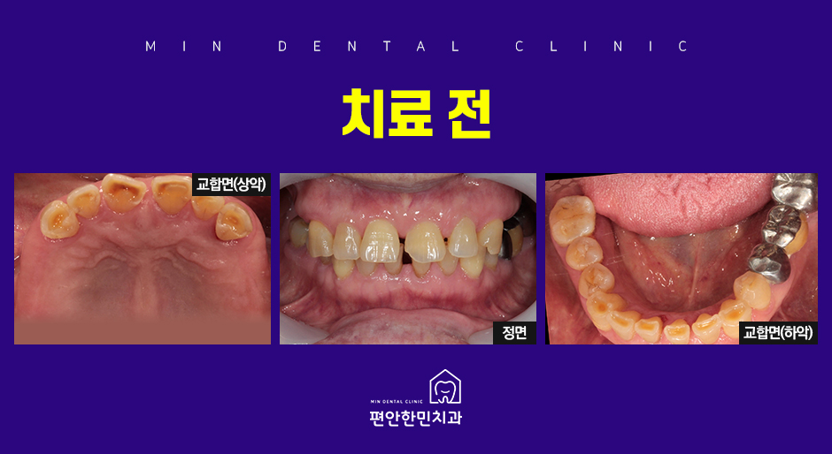 편안한민치과 이미지
