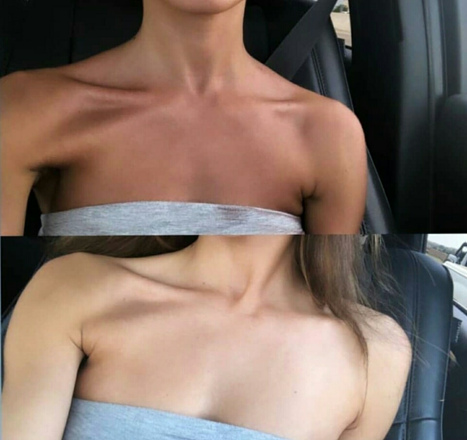 찐태닝 이미지