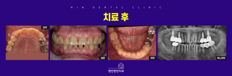 편안한민치과 이미지