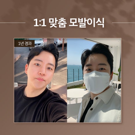 더헤어라인성형외과의원 이미지